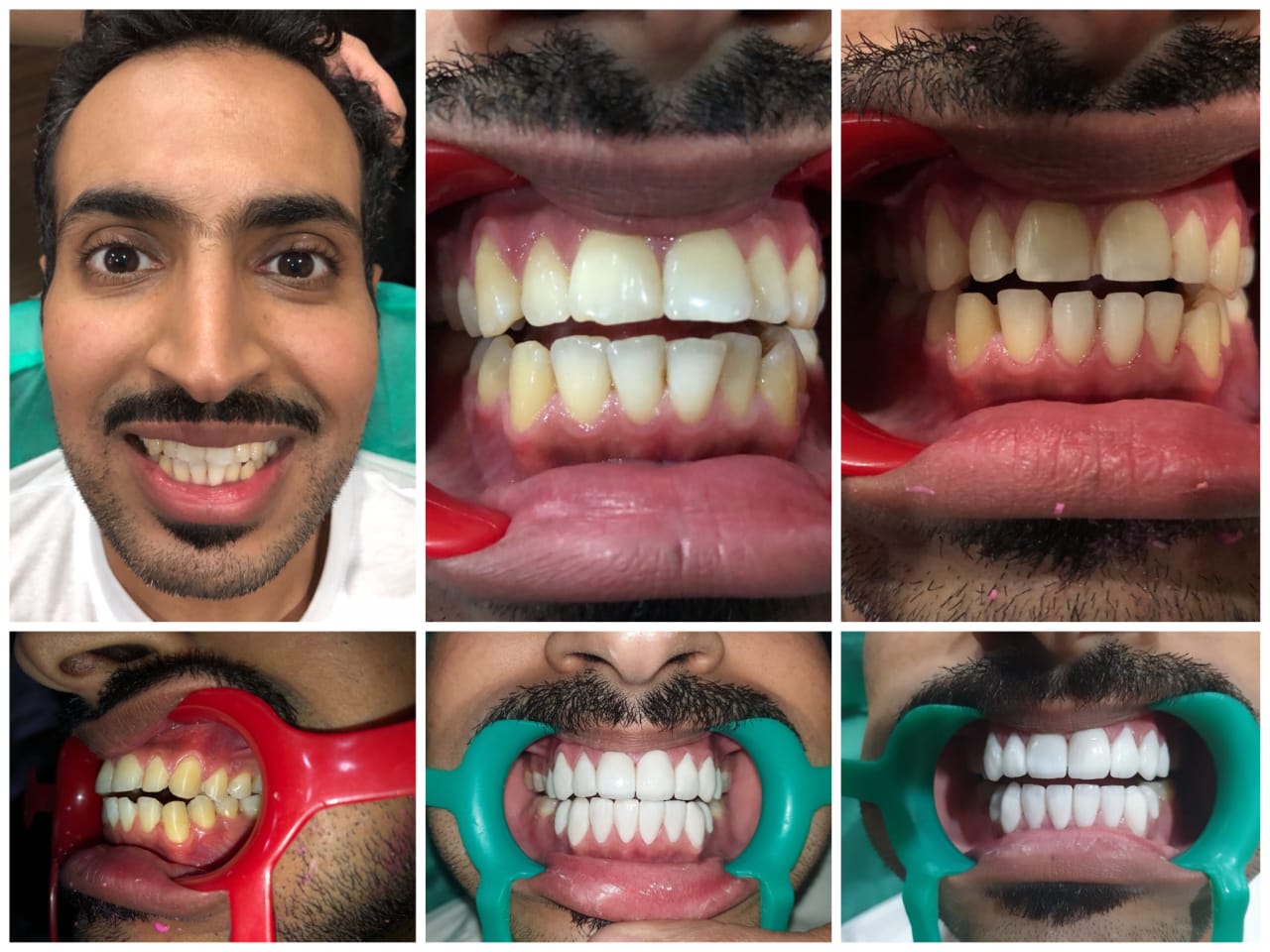 Shabeerali's Dental Care