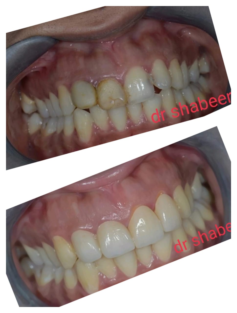 Shabeerali's Dental Care